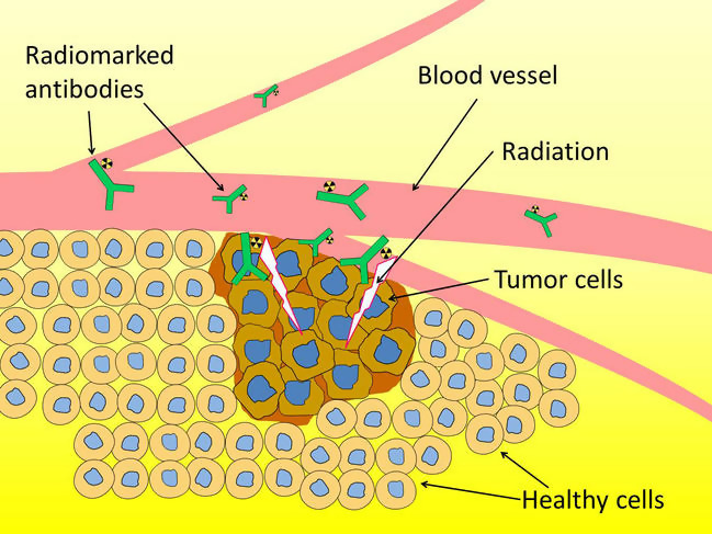 Astatine: Uses, Properties and Interesting Facts